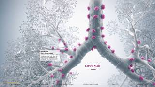 EBUS guide for patients bronchoscopy technique for chest abnormalities [upl. by Petta]