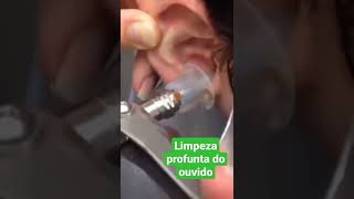 Lavagem do ouvido  Um lavagem profunda  PARTE 1 [upl. by Estel]