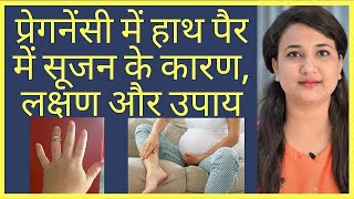 प्रेगनेंसी में हाथ पैरों में सूजन । swelling in pregnancy। pregnancy care in Hindi। [upl. by Chip]