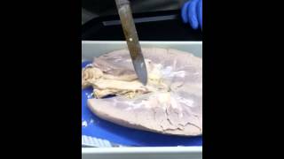 AampP II Lab  pig kidney dissection [upl. by Elleinet540]