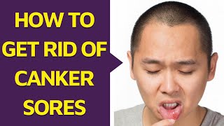 How To Get Rid Of Canker Sores [upl. by Hatty322]