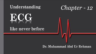 Learning ECG like Never before Ch12  SVT AVNRT OrthodromicAntidromic AVRT amp Retrograde Pwaves [upl. by Ecnatsnok]