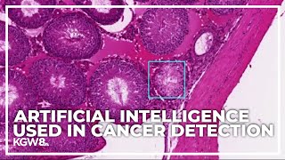 AI model spots signs of cancer gene problems within minutes [upl. by Ylloj]