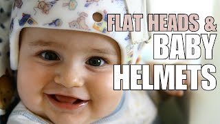 Pediatrician Explains Plagiocephaly Flattening of Head and Helmeting Baby Helmets [upl. by Kosiur]