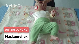 Asymmetrischer tonischer Nackenreflex  Pädiatrie  Frühkindliche Reflexe  AMBOSS Video [upl. by Euqinorev680]