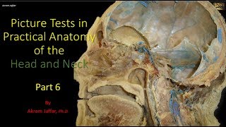 Picture tests in head and neck anatomy 6 [upl. by Atinaej]