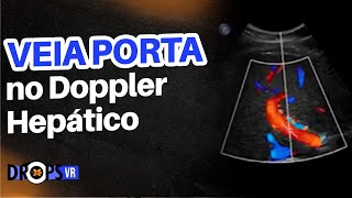 ANATOMIA VASCULAR NO DOPPLER HEPÁTICO – VEIA PORTA I VOCÊ RADIOLOGISTA [upl. by Hawkins]