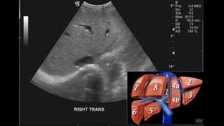 Introduction to the interpretation of Abdominal Ultrasound [upl. by Ellatsyrc]