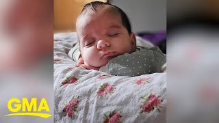 Baby girl born with rare 4pound tumor [upl. by Enomed610]