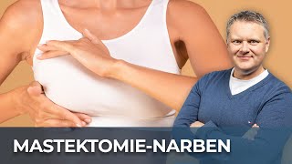 Mastektomienarben lindern Effektive FaszientherapieTechniken I Selfcare Challenge [upl. by Airrehs883]