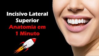 Anatomia do Incisivo Lateral Superior  Resumo de Anatomia Dental [upl. by Lerud785]