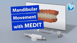 Mandibular Movement with Medit [upl. by Zetram]