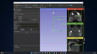 Cropping a CBCT Scan [upl. by Irek]