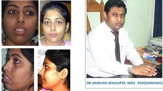 ARPITA SHEULI DASDR ANIRVAN SENGUPTAS PATIENTs INTERVIEW AFTER TREATMENT [upl. by Eznyl]