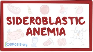 Sideroblastic anemia  causes symptoms diagnosis treatment pathology [upl. by Nymrak]