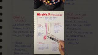 Bursitis retrocalcanea [upl. by Stavros]