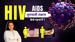 HIV Symptoms in Men amp Women  AIDS Aur HIV ke Lakshan Kya Hote Hai [upl. by Atinnor]