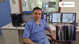 Lets Talk about Digital Subtraction Angiography [upl. by Ssidnak]