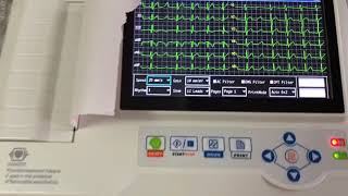 Electrocardiógrafo ContecMed ECG0600G  Soft ECGSYNC [upl. by Korns]