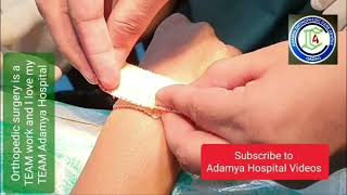 Ganglion  Dorsum wrist Ganglion  Bible cyst Aspiration  Adamya Hospital Videos [upl. by Idyh]