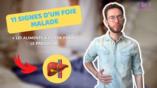 11 SIGNES DUN FOIE MALADE  LES PIRES ALIMENTS TOXIQUES À ÉVITER [upl. by Nino833]