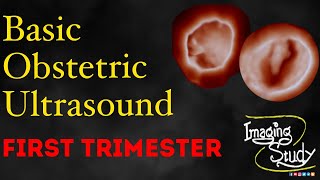 Basic Obstetric Ultrasound First Trimester Pregnancy [upl. by Feriga]