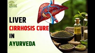 Cirrhosis of Liver Ayurvedic Treatment cirrhosis liver liverdiseaseawareness liverhealth [upl. by Timus399]