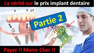 Prix implant dentaire partie 2 [upl. by Ondrea]