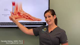 Treating Heel Bursitis and Achilles Tendinopathy with PRP Prolotherapy [upl. by Ailima394]