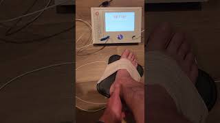 Replexa Shortwave diathermy is a physiotherapy technique great for injuries amp inflammation [upl. by Adnolrehs]