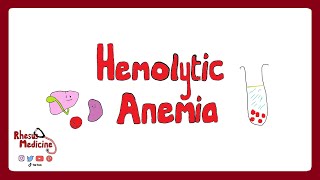 HEMOLYTIC ANEMIA Extravascular v Intravascular Clinical Features Diagnosis Coombs Test  Rhesus [upl. by Atinihs]