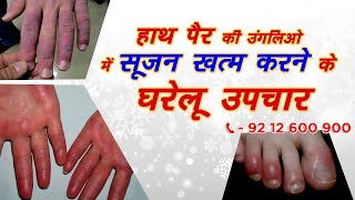 हाथ पैर की उंगलियों में सूजन खत्म करने के घरेलू उपचार  Call Us  9212600900  Health Tips [upl. by Nnaassilem931]