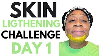 7 DAYS SKIN LIGHTENING CHALLENGE  MY CHIN HAS TOO MANY DARK SPOTS amp BLEMISHES  DAY 1 [upl. by Neiht91]