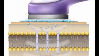 UltraschallVitalwellentherapie mit Vsonic [upl. by Edora217]