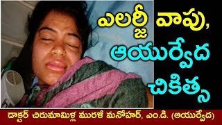 ఎలర్జీ వాపు ఆయుర్వేద చికిత్స  Angioedema allergic swelling and ayurvedic treatment in Telugu [upl. by Broeder460]