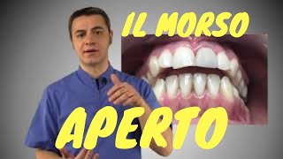 Il Morso Aperto [upl. by Reckford]