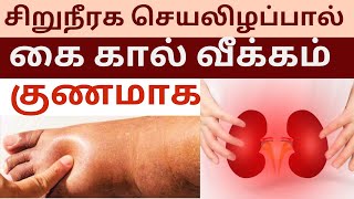 What causes Edema in Kidney Failure  Tamil [upl. by Htiek138]