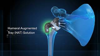 Equinoxe Humeral Augmented Tray Overview Animation [upl. by Drake409]