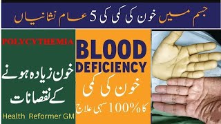 Anemia causessymptoms and treatement urdu hindi Khoon ki kami ka ilagHow to improve hemoglobin [upl. by Einaffit]