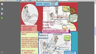 SESSIONS for NURSES 10  CARDIOGENIC AND SEPTIC SHOCK [upl. by Halbert]