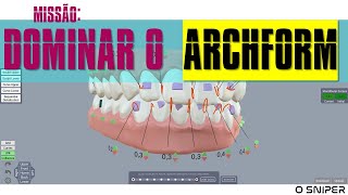 AULA SETUP ORTODÔNTICO  ARCHFORM [upl. by Maryrose]