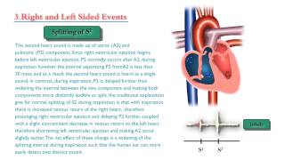 Heart sounds and Murmurs  Only sounds not a lecture [upl. by Samira]