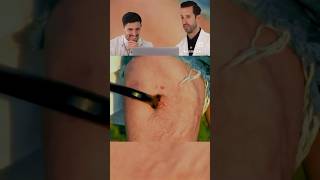 ER Doctor Reacts to my WORST Injuries funny doctor comedy [upl. by Aynwad499]