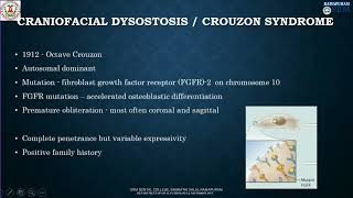 Crouzon Syndrome  Craniofacial Dysostosis Divya B  Department of oral Pathology amp Microbiology [upl. by Suivatna]