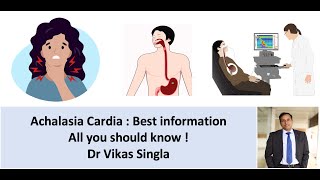 Achalasia cardia  Symptoms causes diagnosis treatment in Hindi Dr Vikas Sing [upl. by Sucrad92]