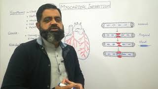 Myocardial infarction Urdu Hindi medium profmasoodfuzail Heart attack  Angioplasty [upl. by Schwinn]