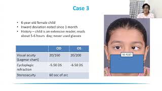 Lecture Acquired Esotropia – What’s New in 2023 [upl. by Badr]