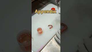 Appendix specimen 🧐👀✂️😭  appendicitis acuteappendix thyroiddisorders appendicularskeleton lab [upl. by Llamaj]