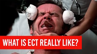 Electroconvulsive Therapy  ECT  What is it REALLY like [upl. by Saunder648]