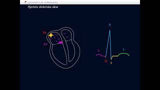 Einthovens trekant og hjertets elektriske akse [upl. by Aelanej]